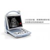 凸阵黑白超声诊断仪DP-10
