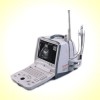 迈瑞DP-6600全数字便携式黑白超声诊断系统