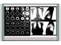 LED 单联调光插片型阅片灯