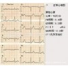 日本杰斯特chest肺功能仪打印纸HI-101