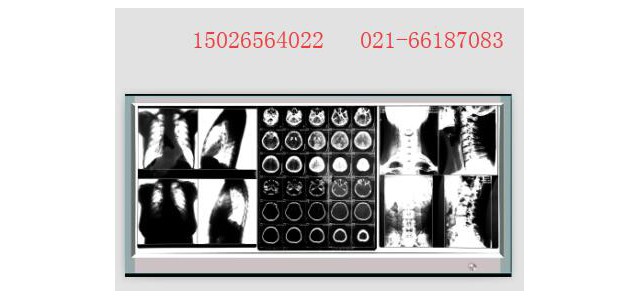 医用x光胶片观片灯三联观片灯，单联超薄单联观片灯