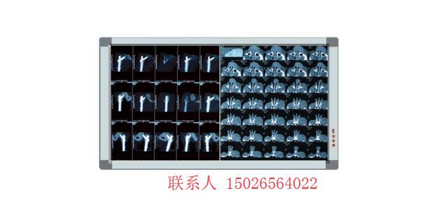 江苏LED医用观片灯报价