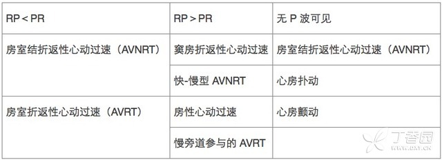 窄 QRS 波心动过速：这些鉴别诊断方法不可不知