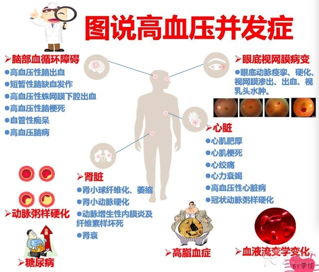 一图读懂：说说高血压并发症