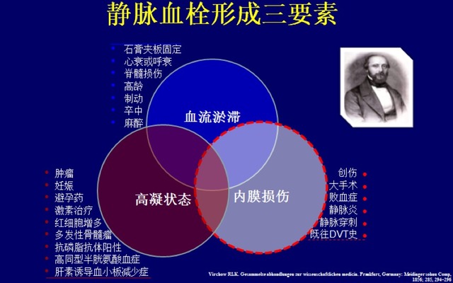 轻松 10 分钟：掌握肺栓塞的临床诊疗经验