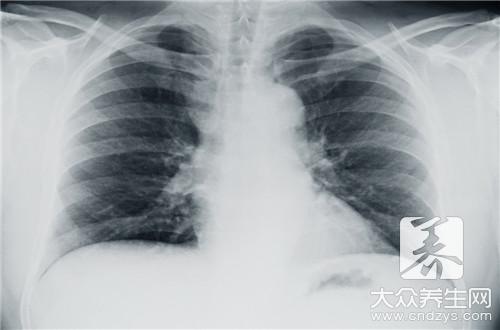 胸疼应该做什么检查