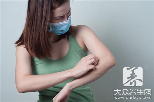 被隐翅虫咬了涂什么药？