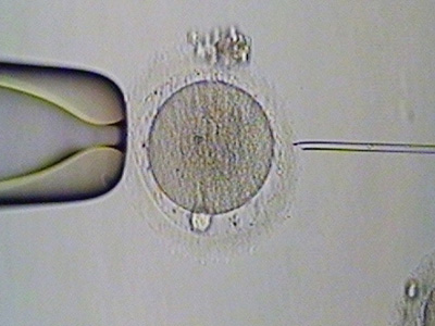 试管婴儿取卵数量越多并不代表受精数量