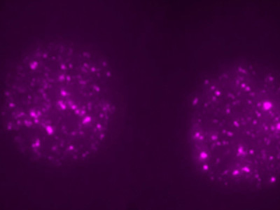 做试管助孕影响价格的因素有什么?