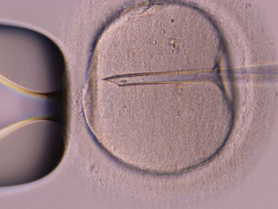 做试管婴儿什么时候打夜针?