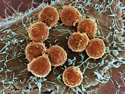 做试管婴儿都需要带什么证件?要注意些什么