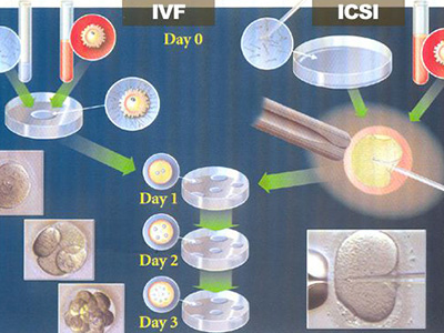 试管婴儿算不算亲生的?专家来为你揭秘