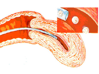 试管婴儿宝宝和天然孕育宝宝的预产期相同吗?