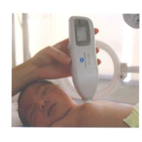 进口日本婴幼儿经皮黄疸测试仪